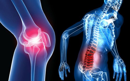 Joint Replacement: What, Why & How to Treat