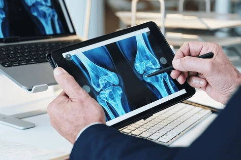 Orthopedics & Joint Replacement